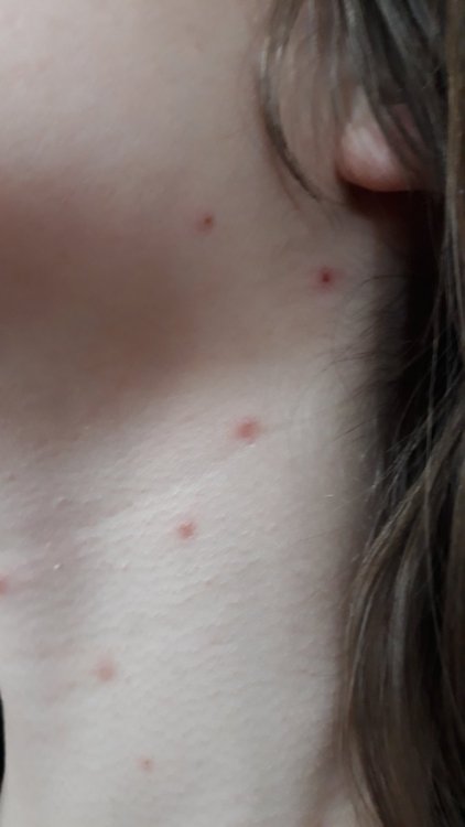 Puntini sul collo.jpg