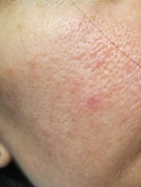 derm 1.jpg