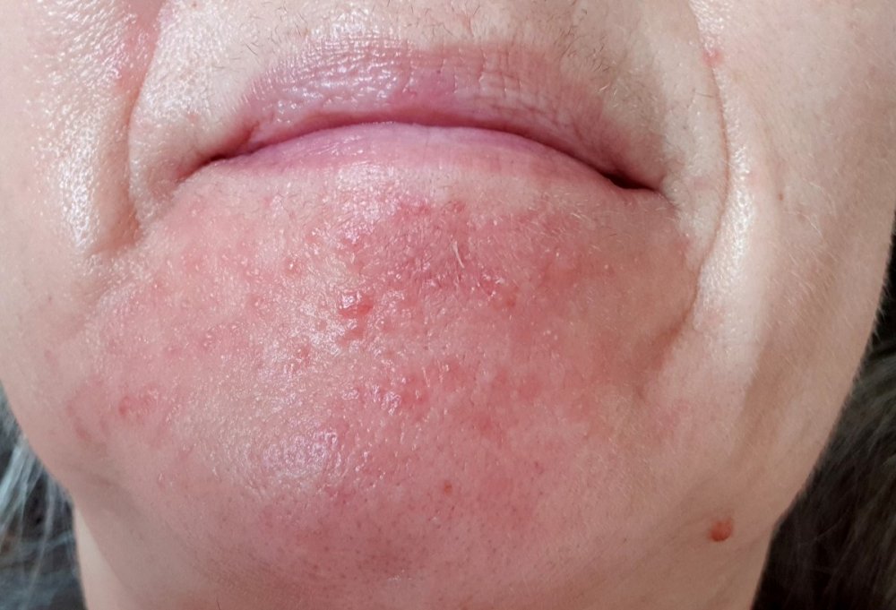 20190529_092218.jpg