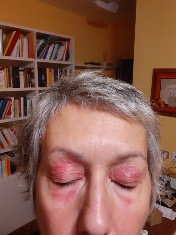 inizio dermatite 1 (Copia).jpg