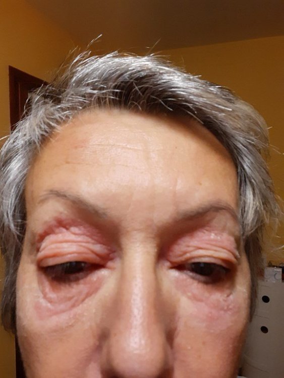 trasformazione in eczema 1 (Copia).jpg