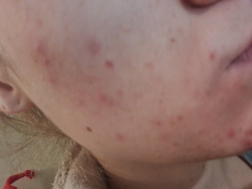 20191113_213235.jpg