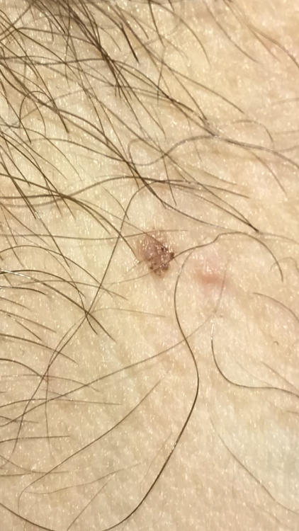 241227E5-35DD-44F0-B333-BF7CCBC020C3.png