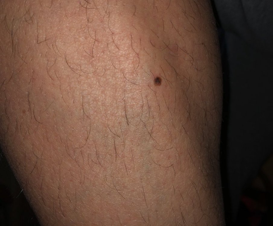 211710959_Senzanome.thumb.jpg.dddab12efabae57c422d695ebc9d0a8c.jpg