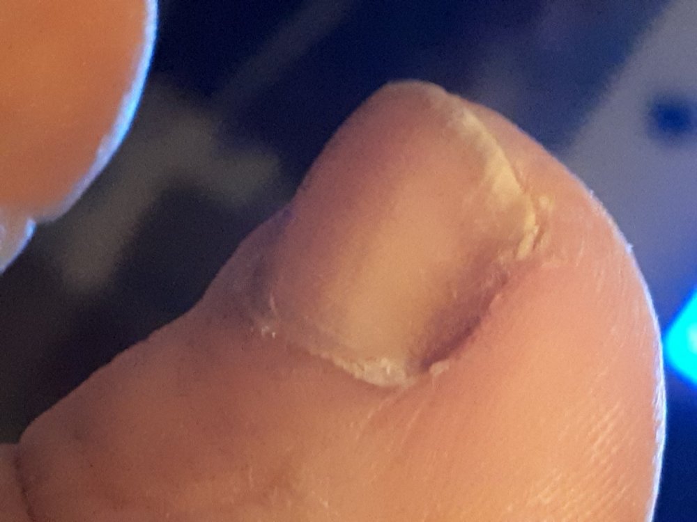 15877549724771795442973534023733.thumb.jpg.ef25d8d96884989a40d10f4de357bfa7.jpg