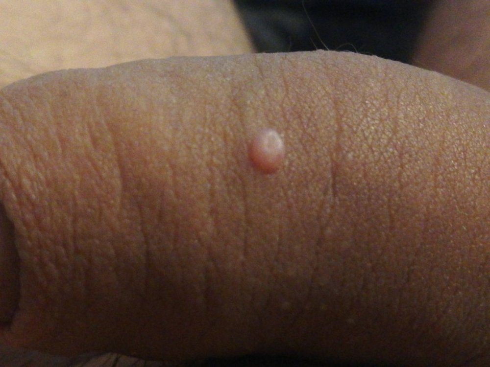 15900760927797988050372125077313.thumb.jpg.642a5870d5f0c347054746ca7fa1e0c1.jpg