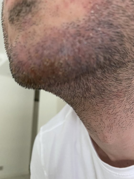B32B2A85-AD58-4088-80C5-595EE428301E.thumb.jpeg.5069d5a2e961dc8929cee27f68c089b1.jpeg