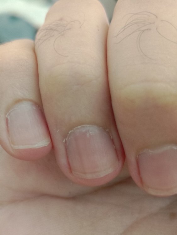 P_20200531_175108.thumb.jpg.a8d9b3afd0e58f868e5682e79fccf0b1.jpg