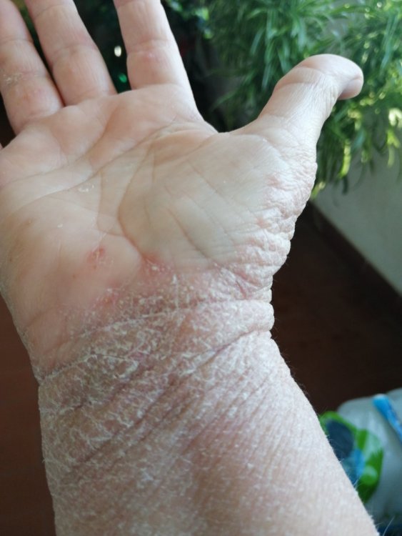 1 giugno polso dx ore diurne.jpg