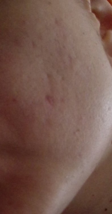 2068023996_fotom.thumb.jpg.34fc405c1f676fcce7299628004744dc.jpg