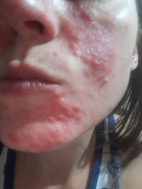 15967324187028489245963614697457.thumb.jpg.0939637ac77406467ca8cd7a43ec3794.jpg