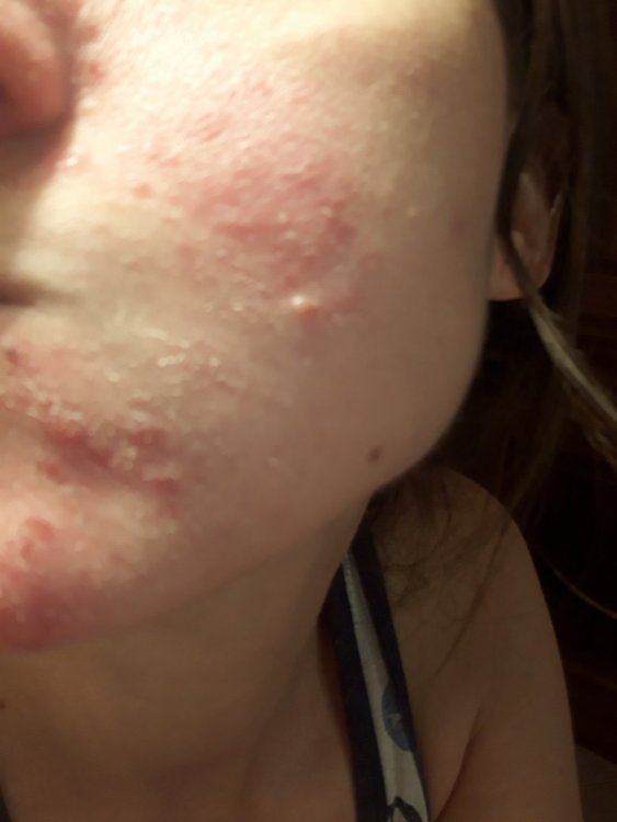 1597235872453574843196251494440.thumb.jpg.076b075b50de9f28a79da7a2ec814e4d.jpg