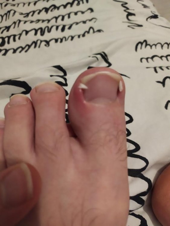 unghia1.jpg
