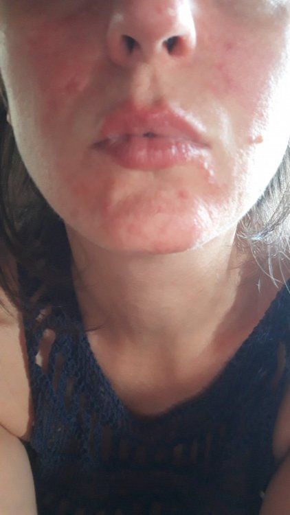 16001774414745652842560363031445.thumb.jpg.28796b9c80ebdd9dcb362ca8e375a3e9.jpg