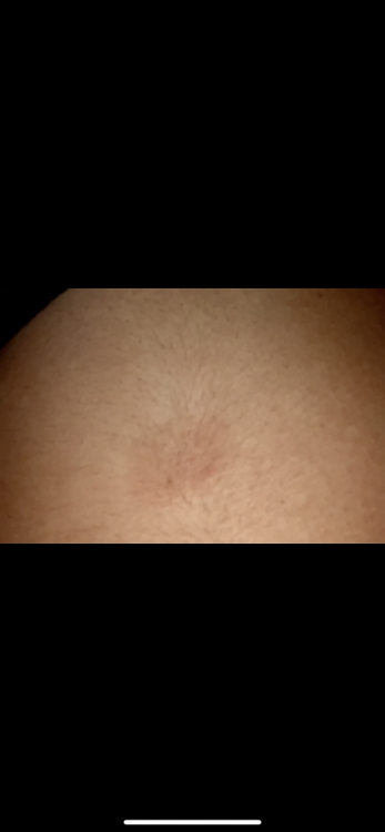 DCE0A1D1-629E-474C-B970-083F7A36DF71.png