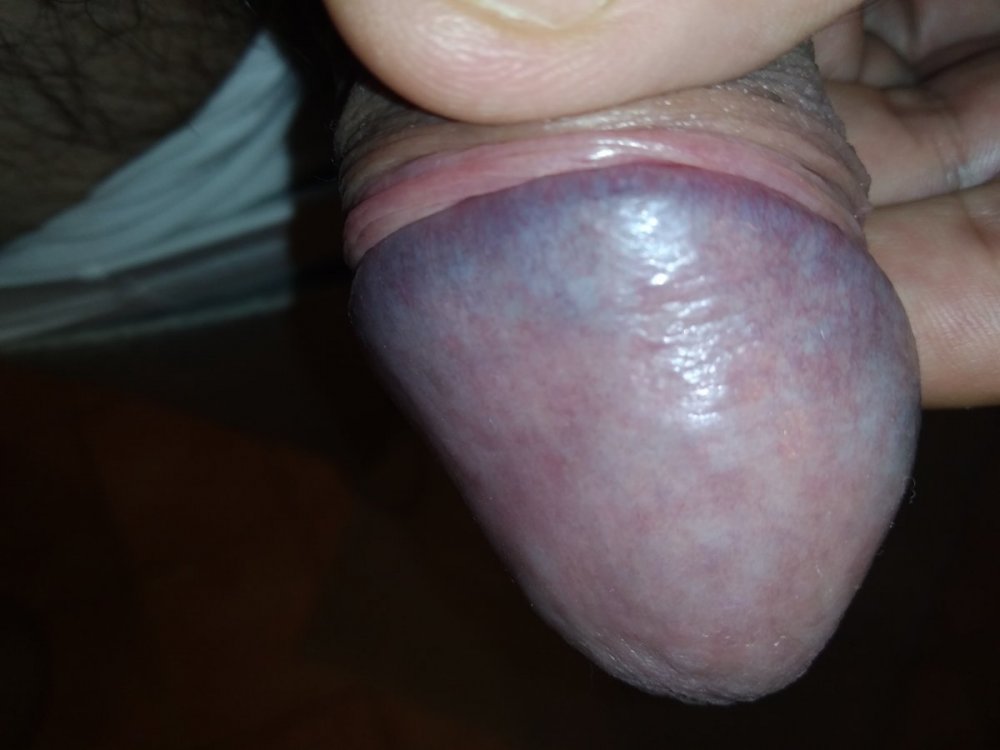 IMG_20201111_204645.jpg