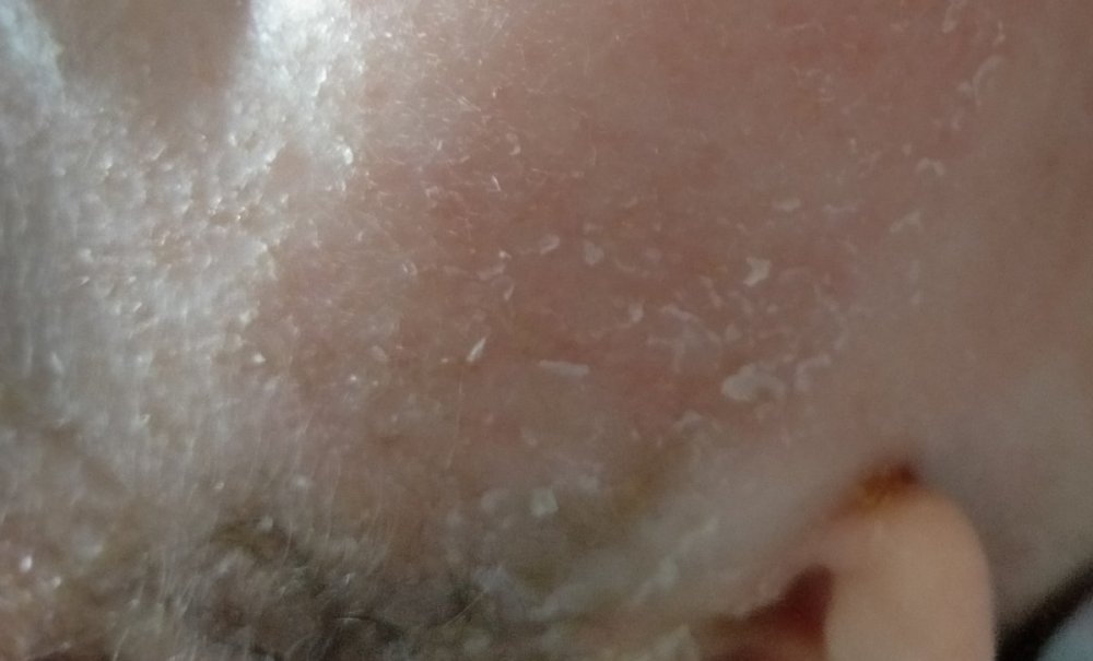 IMG_20201126_102302.jpg