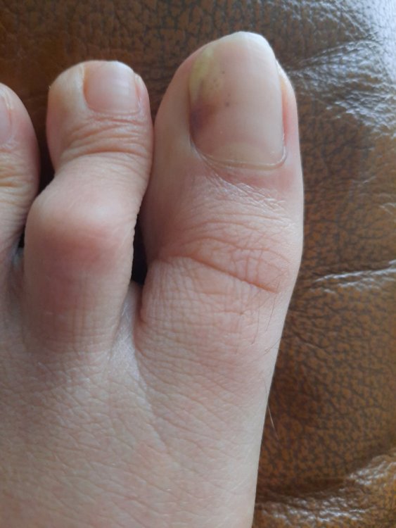 20201201_113557.thumb.jpg.3d54ac6b6b94b641ced19bf55c55ef72.jpg