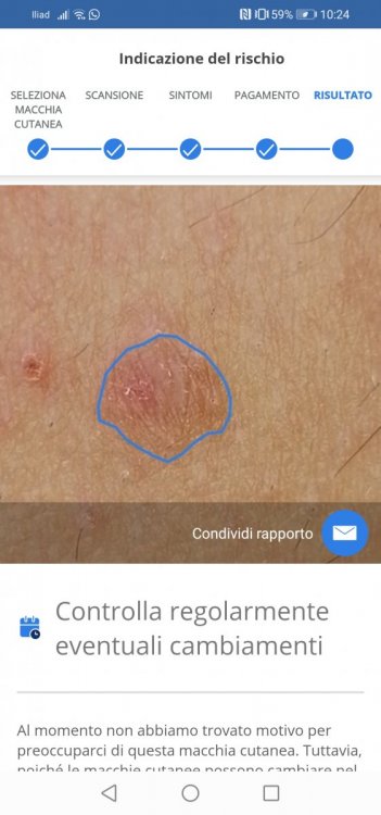 Screenshot_20210228_102417_com.rubytribe.skinvision_ac.thumb.jpg.fb9cf0f8dc68de771307262ff64223cd.jpg