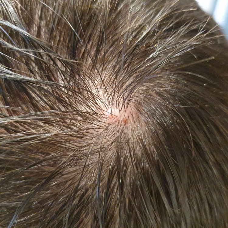 20210318_142239.thumb.jpg.9abcecf18a36ded7b12ee22007eba89e.jpg
