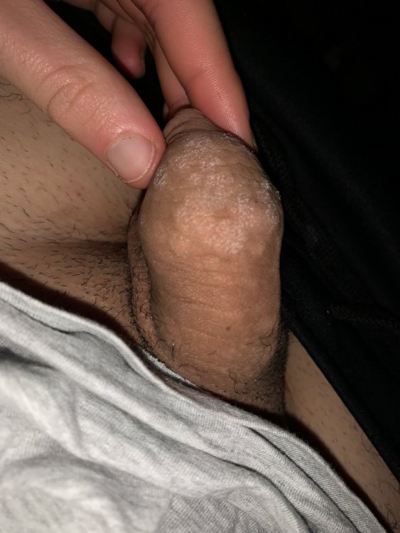 ED59D4CD-D9E1-4229-9A89-2A2B43F8104D.thumb.jpeg.e722fb1baf3cb54b8d7fbb1592b713f3.jpeg