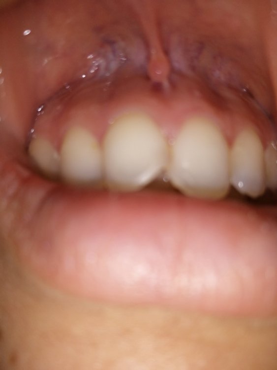 IMG_20210311_103525.jpg