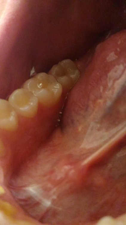 P_20210301_181359.thumb.jpg.5aecc1c11d401c5a3d1ff9eb6a505bb0.jpg