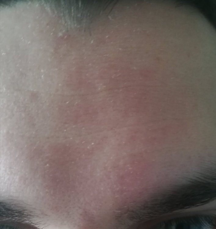 derma1.jpg