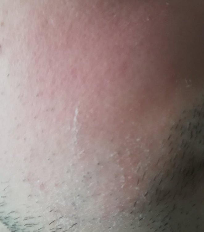 derma2.jpg