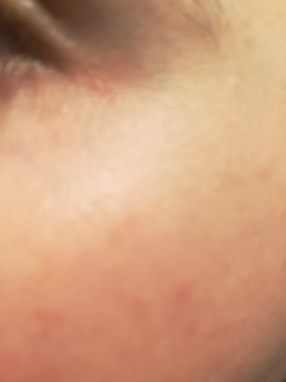 derma3.jpg