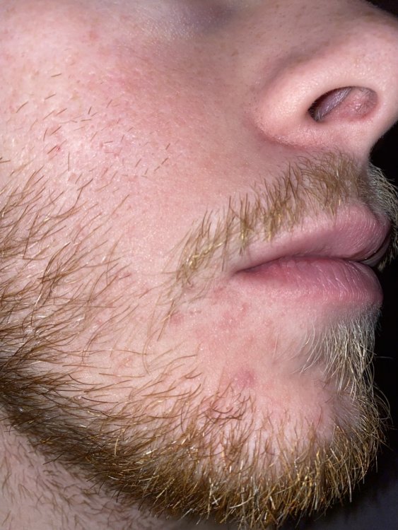 image.thumb.jpg.797e200884454c6285eb16faa6257d0f.jpg
