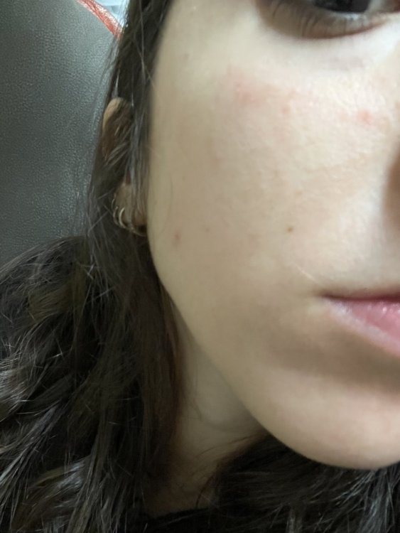 micropeeling1.jpg