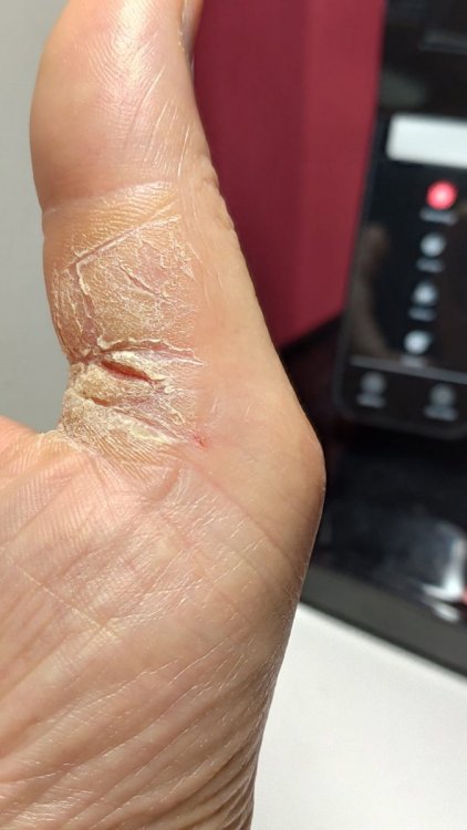 mano dx.jpg