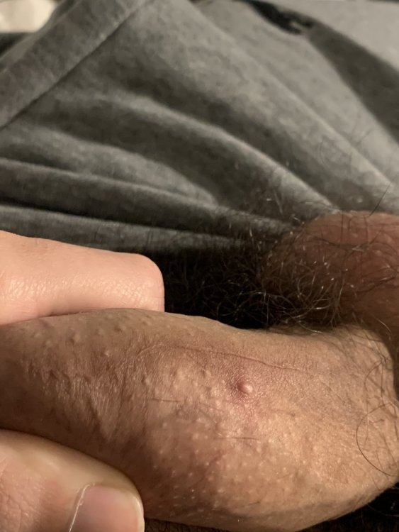 E6B91408-2F5A-4CA2-9EFA-024EA81379AD.thumb.jpeg.a4b5d1407e46fa96bafb2dbf2b057159.jpeg