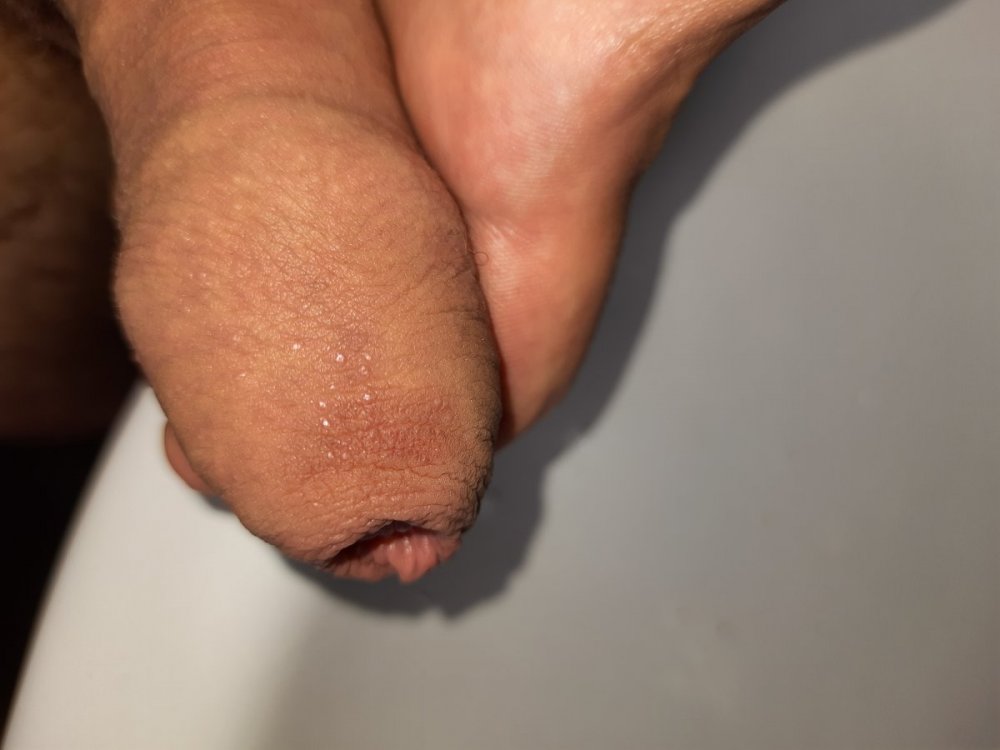 16241804163677060571523624722072.thumb.jpg.33a96934afc52a8857c8a51c88413e87.jpg