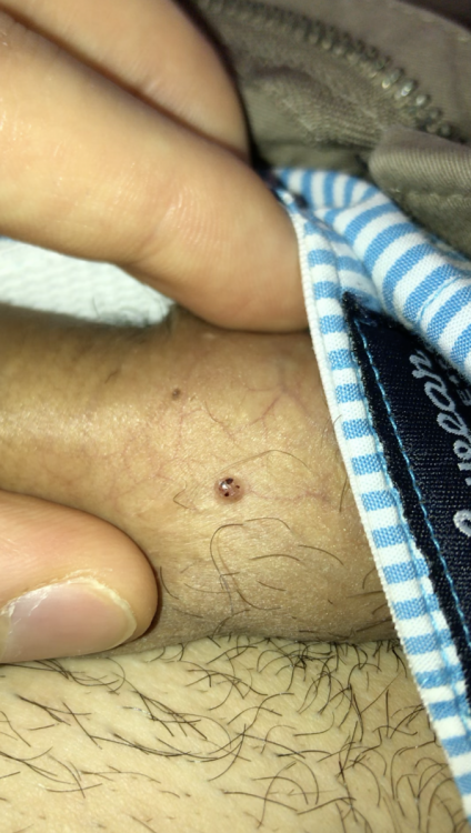 526084806_Schermata2021-06-17alle18_03_30.thumb.png.a1ebdfe4ad59dca30c1dba5e0e5a67d4.png