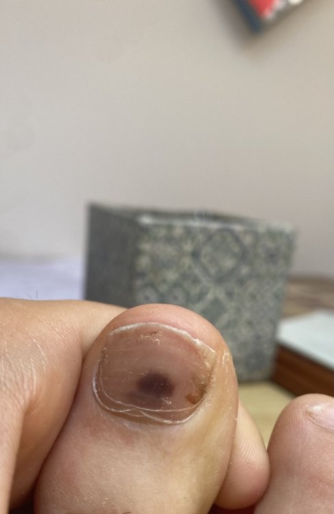 E62BB9C9-BAE8-4CA6-B192-7D488759B3C7.thumb.jpeg.8c5c194408c5d2ea55ea782dfc5934b8.jpeg