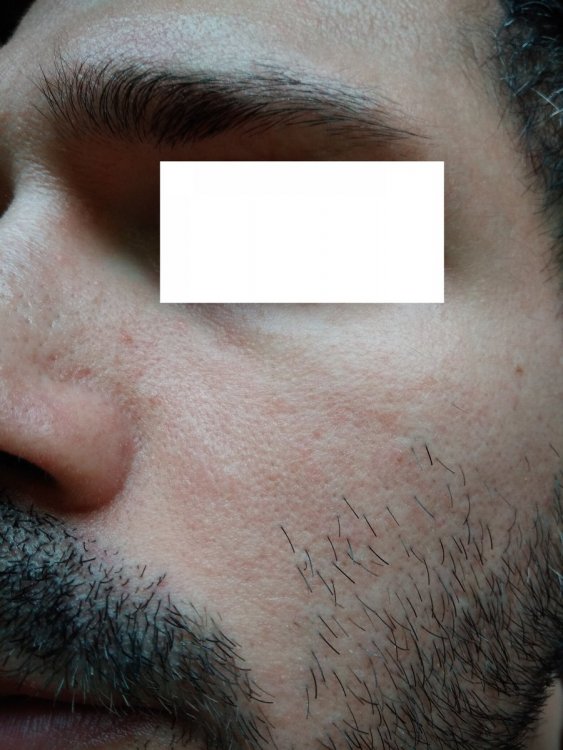 1408018433_Viso01.thumb.jpg.25e41e1f300d676265f6987f782d9cfb.jpg