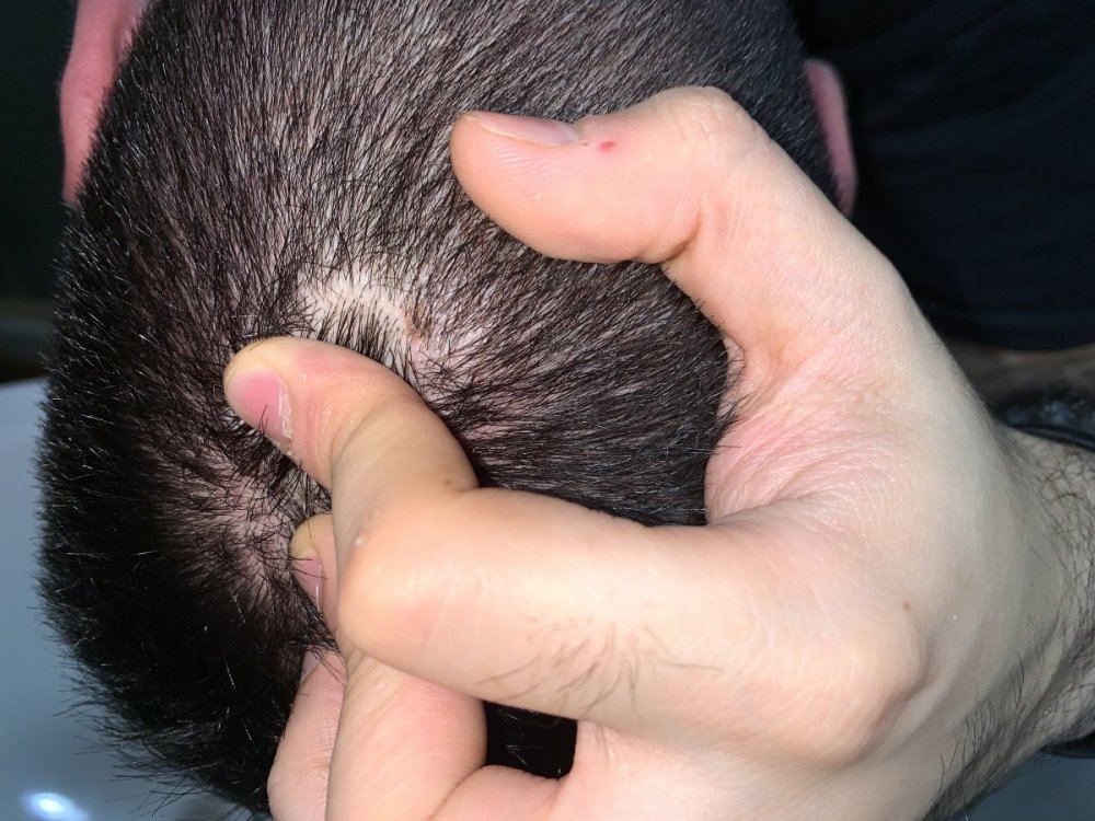 AC6D517A-8FBC-4E64-BEC5-BD764C871E67.thumb.jpeg.daa27cea49dee1644aa71ebc6a8bf84b.jpeg