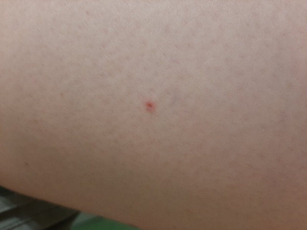 16282587504504756042270653848240.thumb.jpg.a84bfefdf1f6c39346678f926179bee3.jpg