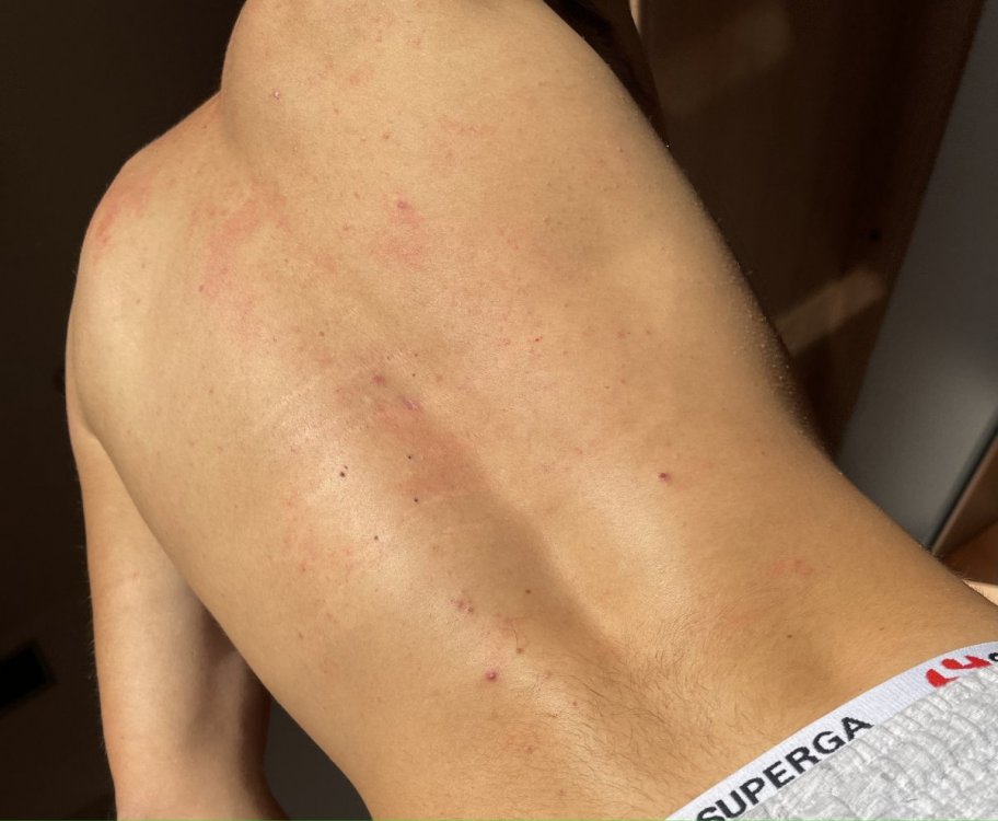 SCHIENA.thumb.jpg.e9955cdc72052564e491f632cc730de7.jpg
