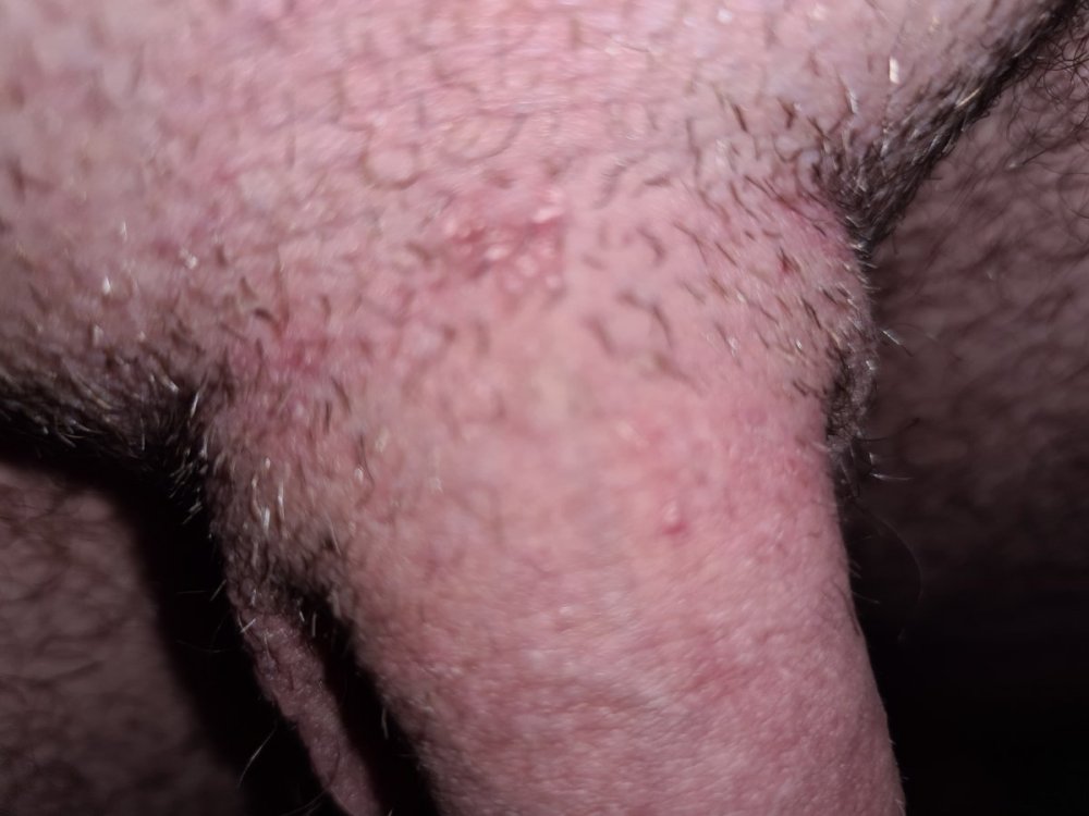 20211219_200020.thumb.jpg.9f13ad68b9a3710c5ce7a35a689ed993.jpg