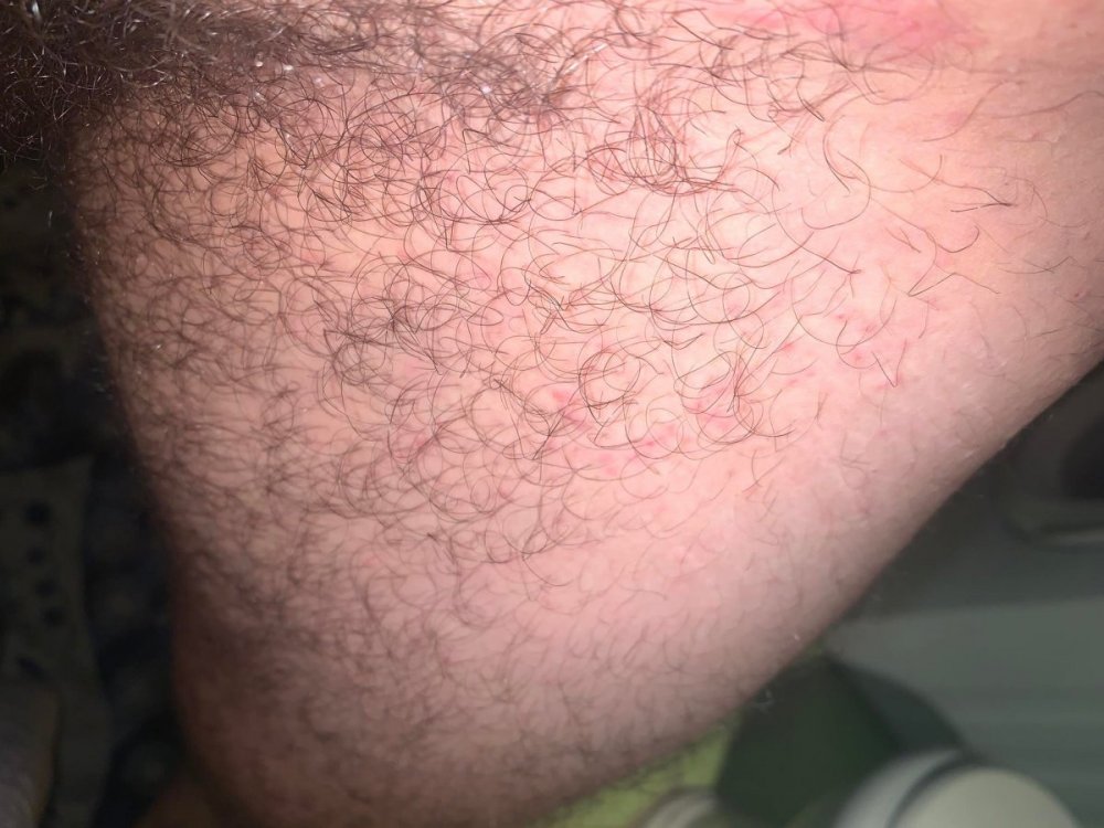 3z.thumb.jpg.fde7e3cb3141e0275a044b1766245c73.jpg