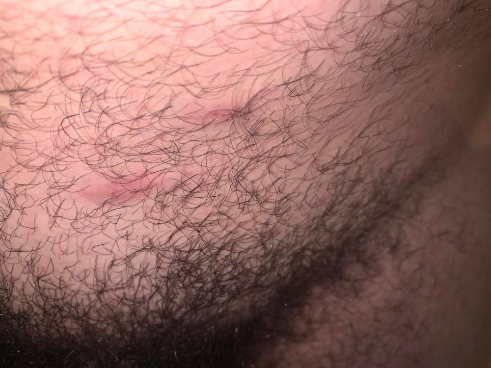 4z.thumb.jpg.6f7546ffd3a0cb845ad31b5735910e44.jpg