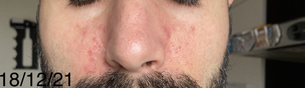D44216A4-E92A-494D-8997-EFF494D99F4A.jpeg