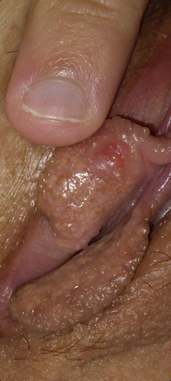 Screenshot_20211217-202244_Gallery.jpg