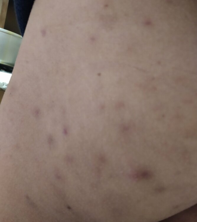 1644670214947.thumb.jpg.be347140a820586dbed6f90e3ead2b6f.jpg
