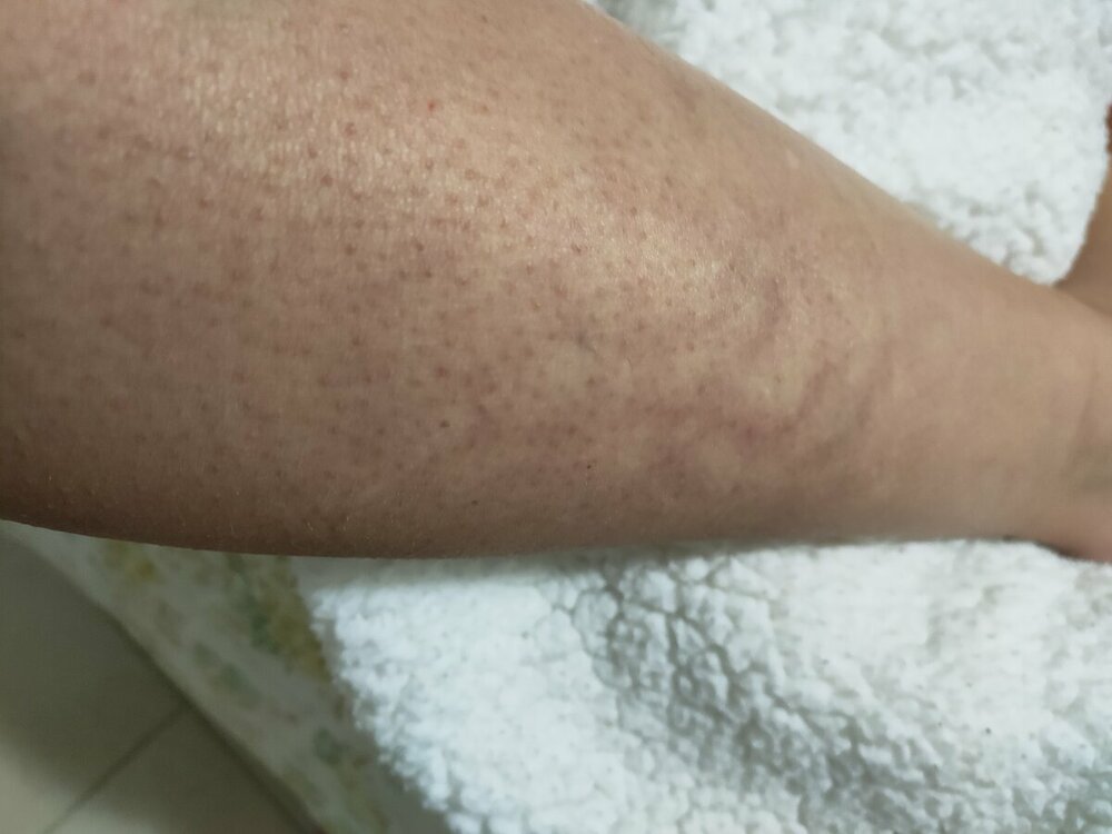 IMG20220208193617.jpg