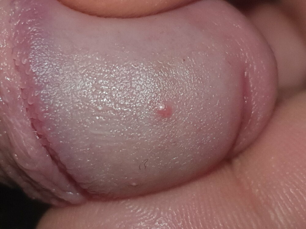 20220320_104858.thumb.jpg.08b512846bc6bc02c2c552d3702a7b40.jpg