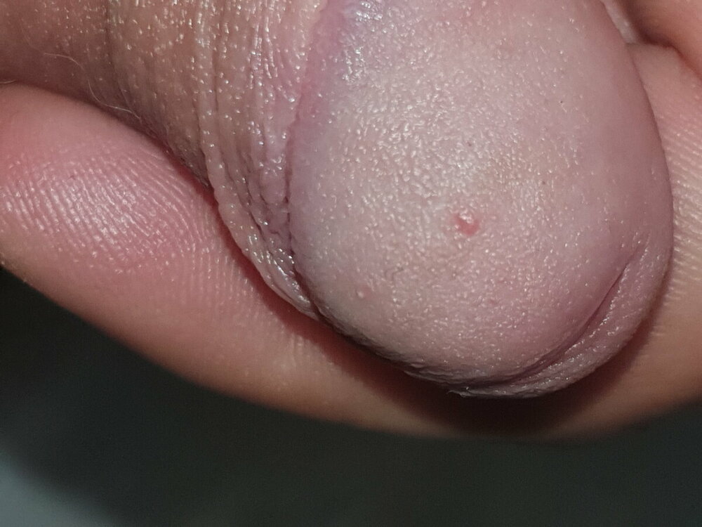 20220320_104924.thumb.jpg.3a5c574f29c2088afb654b913369ed94.jpg